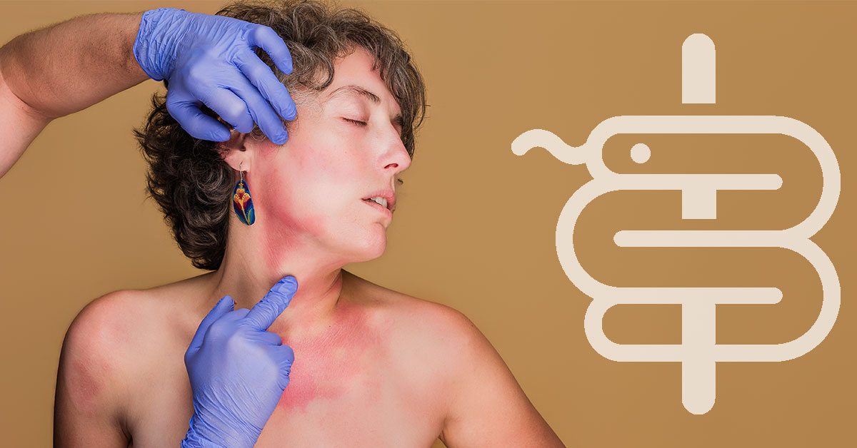 Alergia solar: cómo reconocerla y tratarla antes de que empeore
