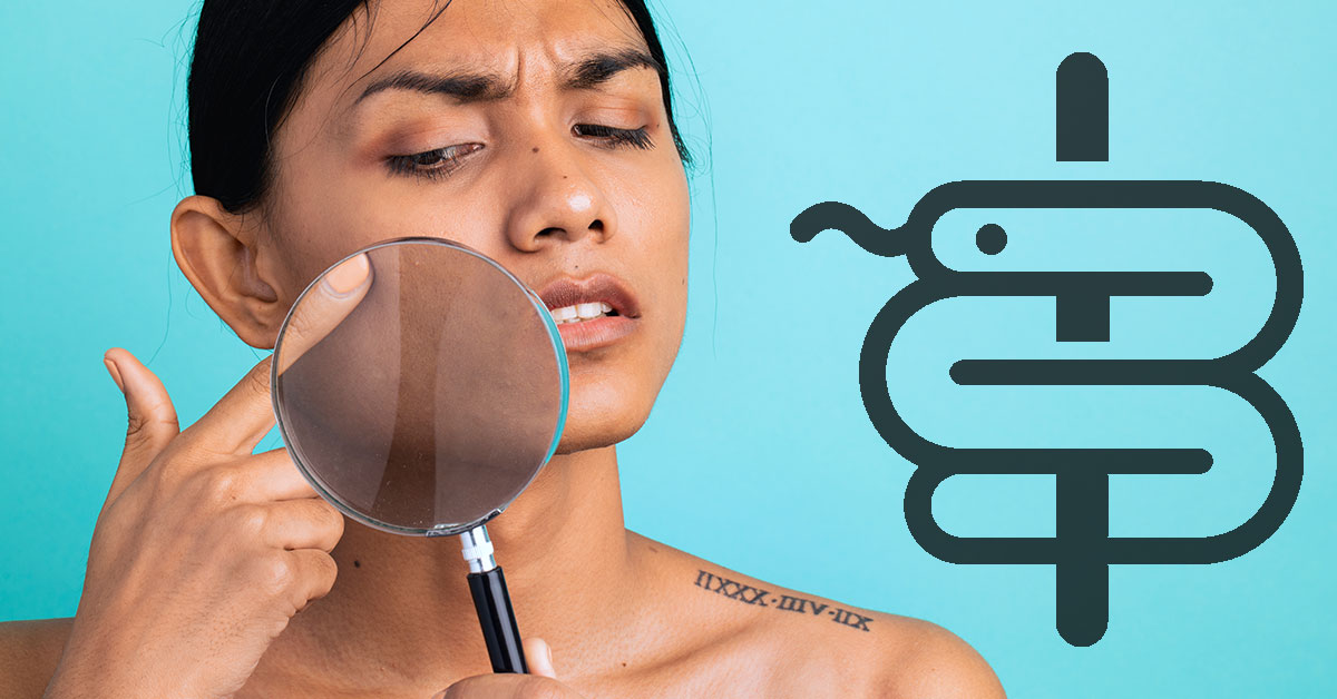 Manchas circulares oscuras en la piel: hongos, melasma o dermatitis