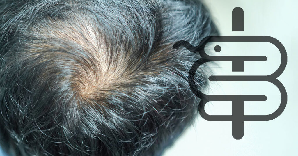 finasterida-y-pelo