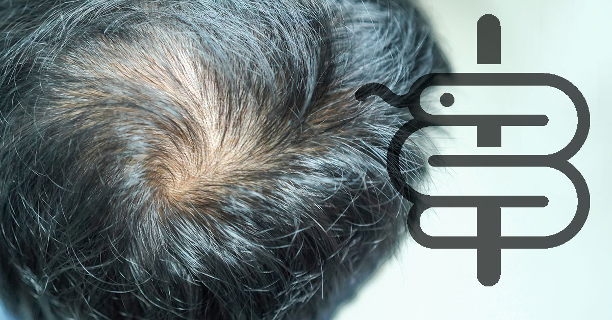 Finasteride (finasterida): cómo actúa y qué efectos tiene