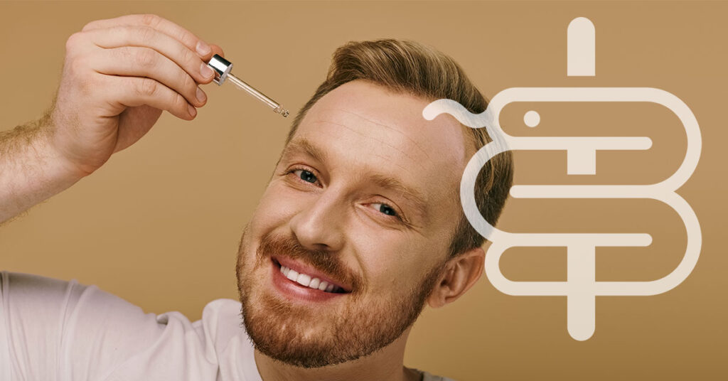 minoxidil-caida-del-pelo