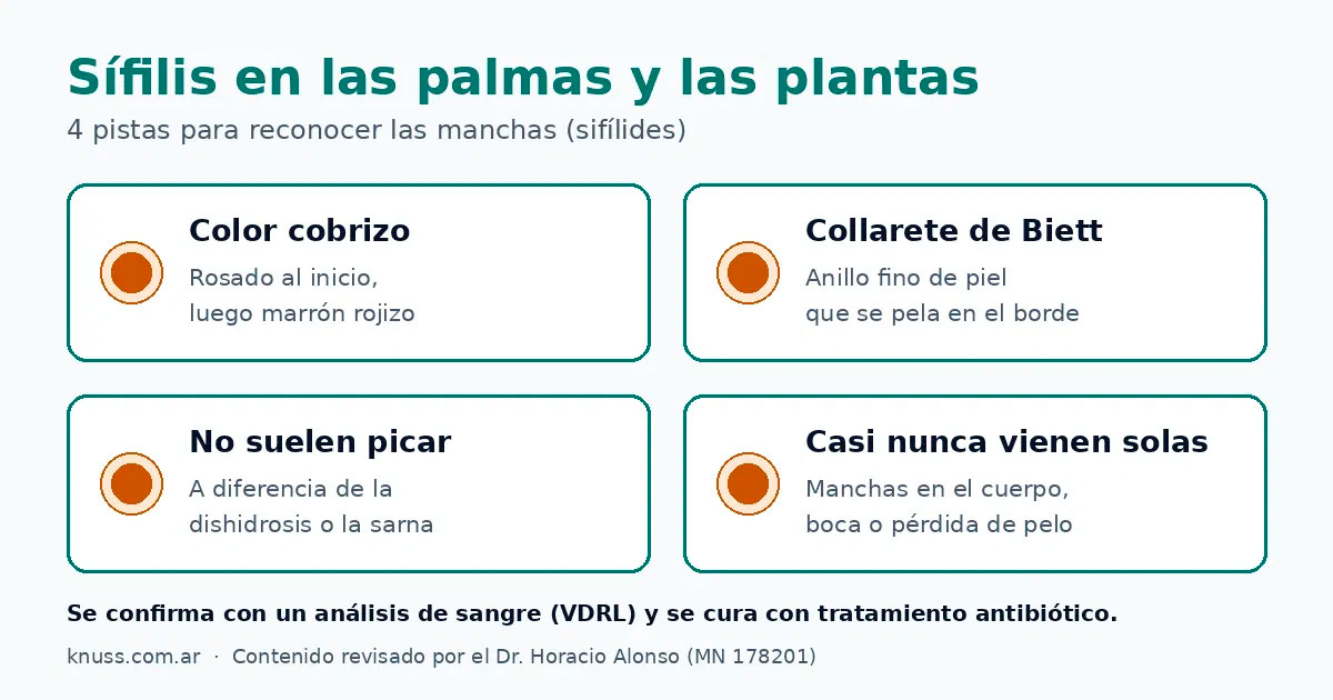 Pistas para reconocer la sífilis en las palmas de las manos y las plantas de los pies