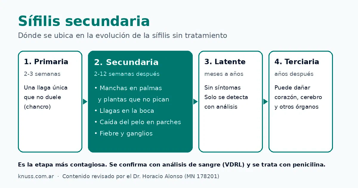 Infografía de la sífilis secundaria y las etapas de la sífilis: primaria, secundaria, latente y terciaria